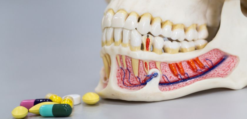 All The Antibiotics Used In Gum Disease