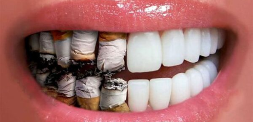 Smoke After The Dental Implant Procedure