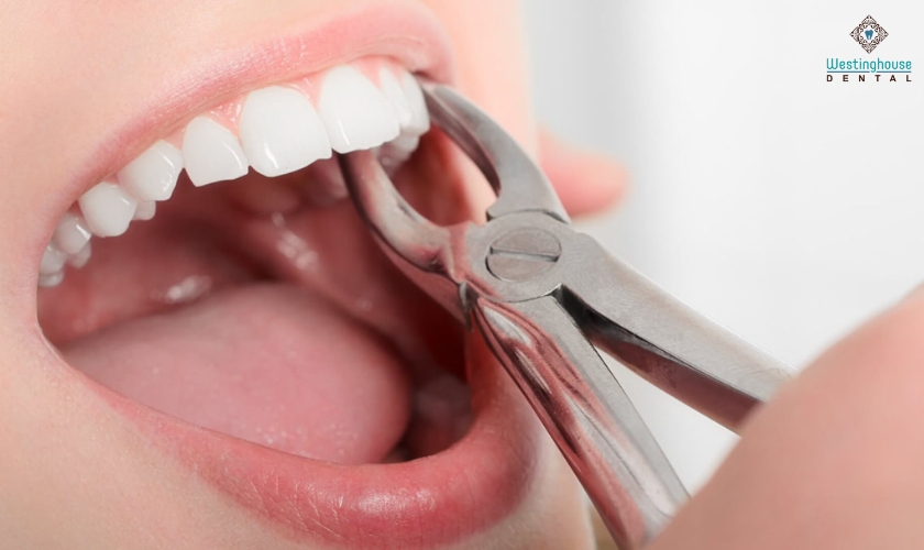 How Do You Calm Down Before Tooth Extraction