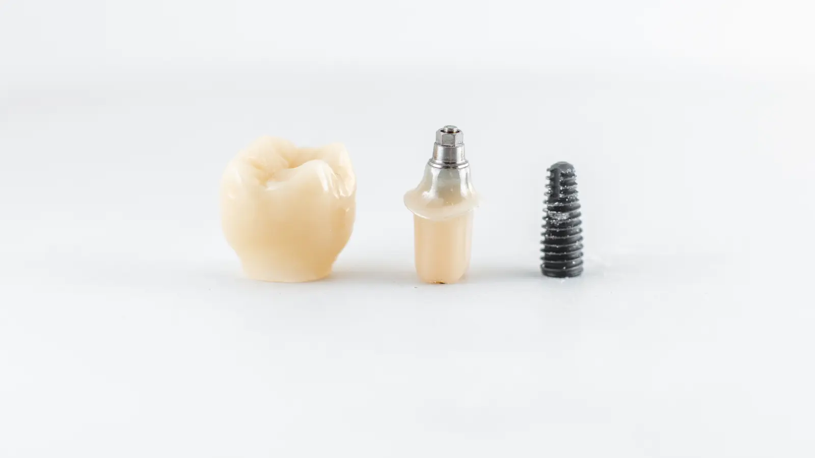 Prepare Yourself for a Dental Implant Procedure