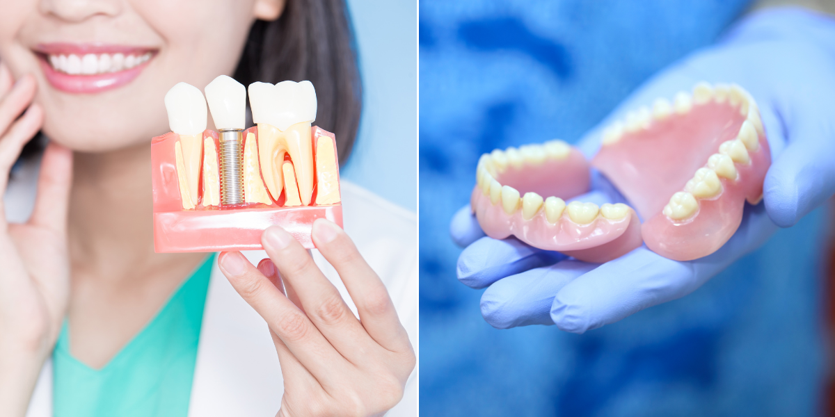 dental implants vs dentures