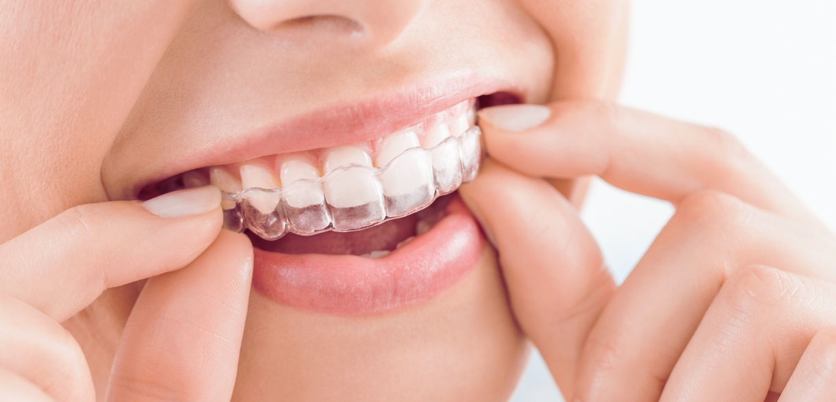 can invisalign fix complex orthodontic issues