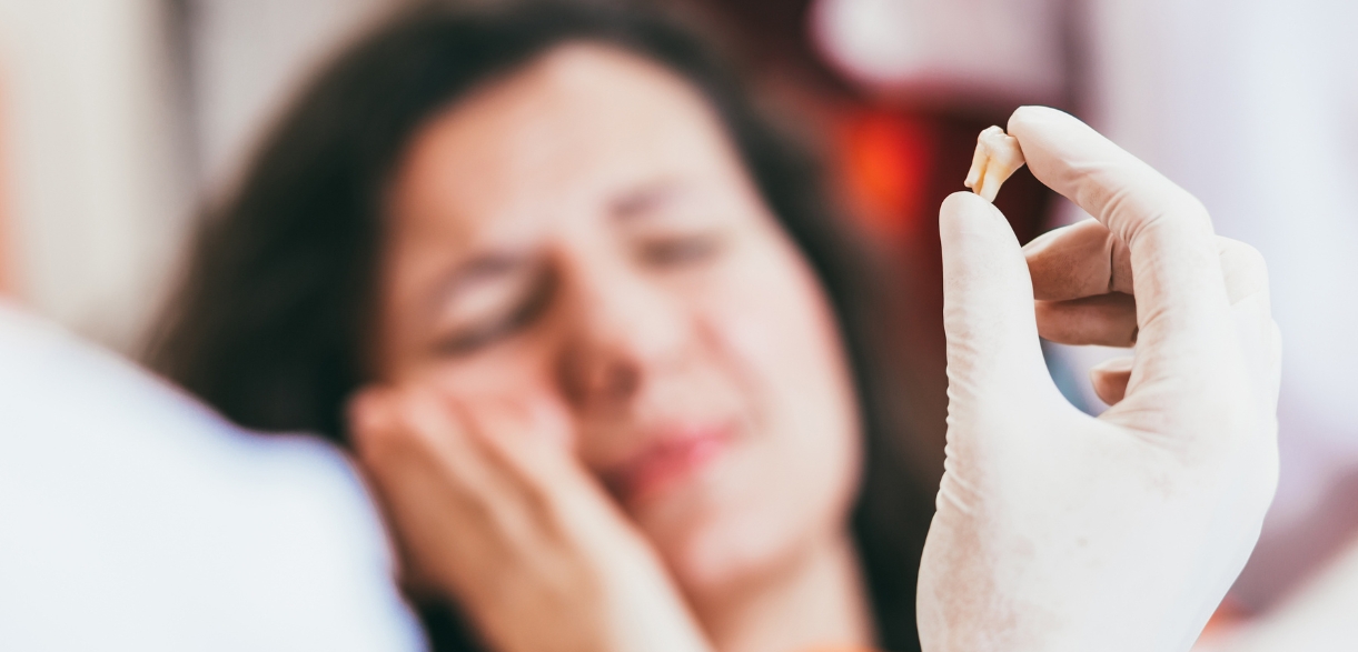 Can I Brush My Teeth After Wisdom Teeth Removal?