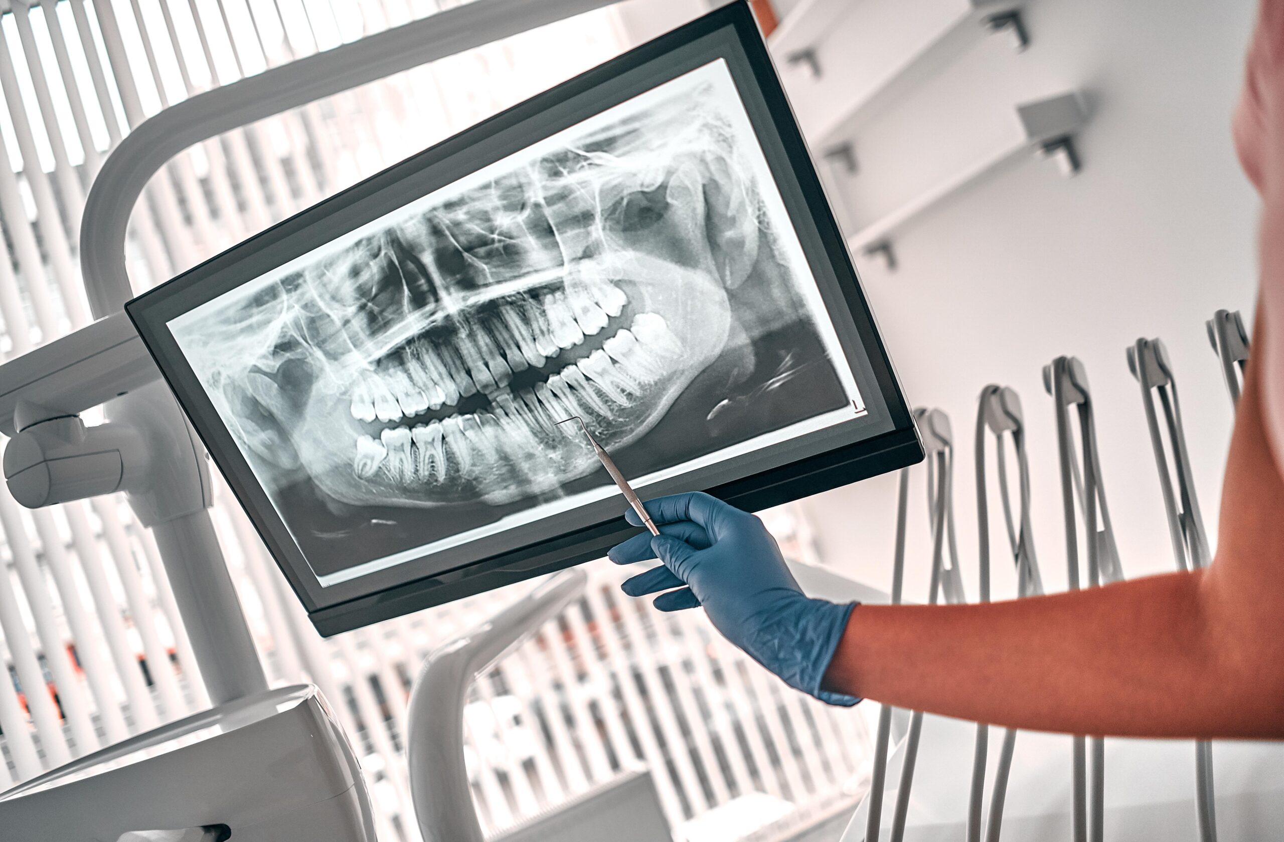 Dentist demonstrating 3D dental xray image